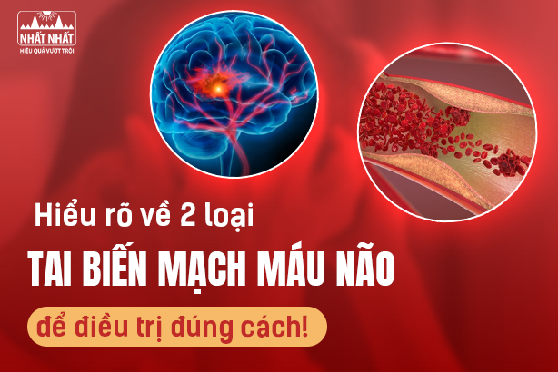Hiểu rõ về 2 loại tai biến mạch máu não để điều trị đúng cách!