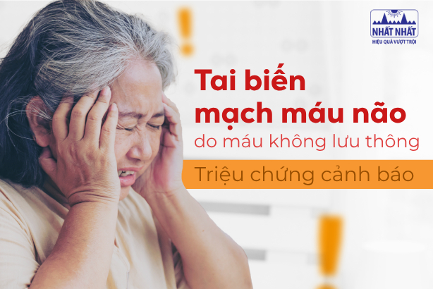 Tai biến mạch máu não do máu không lưu thông: Triệu chứng cảnh báo