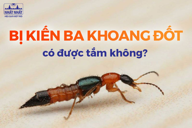 Tư vấn: Bị kiến ba khoang đốt có được tắm không? 