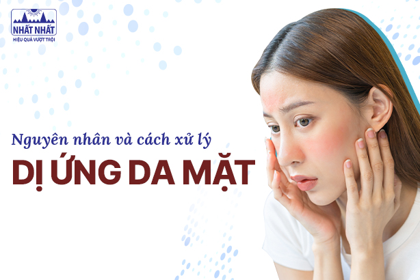 Nguyên nhân và cách xử lý dị ứng da mặt an toàn
