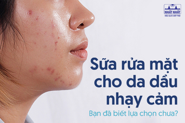 Sữa rửa mặt cho da dầu nhạy cảm: Bạn đã biết lựa chọn chưa?