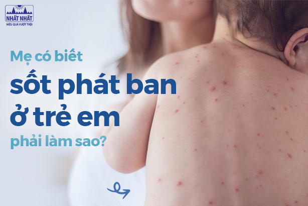 Mẹ có biết sốt phát ban ở trẻ em phải làm sao?