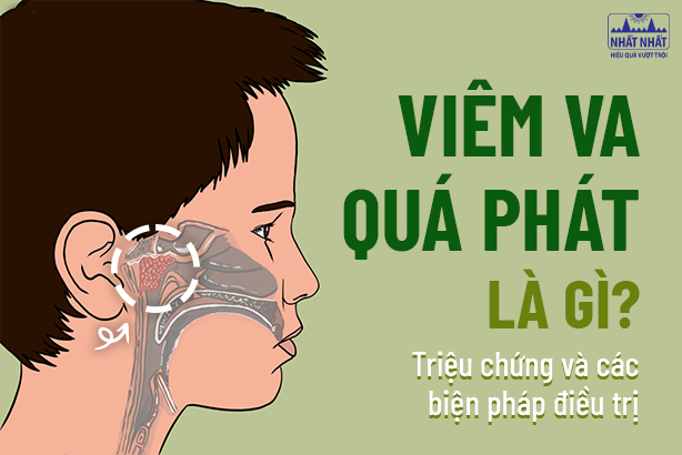 Viêm VA quá phát là gì? Triệu chứng và các biện pháp điều trị 