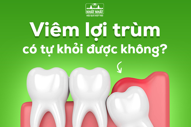 Hỏi nhanh đáp gọn: Viêm lợi trùm có tự khỏi được không? 