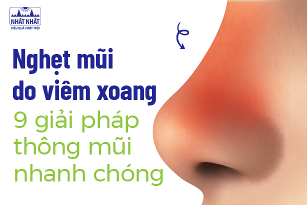 Nghẹt mũi do viêm xoang: 9 giải pháp thông mũi nhanh chóng