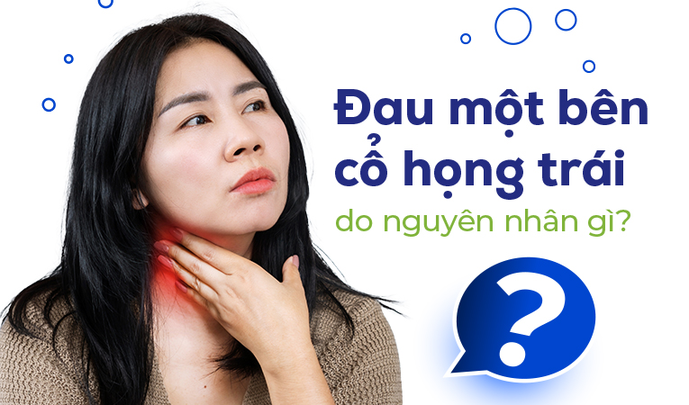 Đau một bên cổ họng trái do nguyên nhân gì?