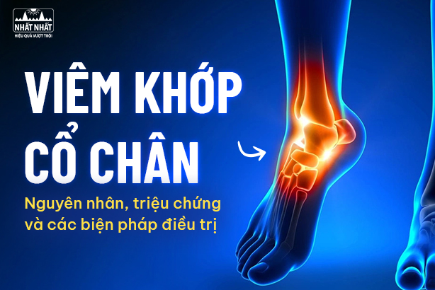 Viêm khớp cổ chân: Nguyên nhân, triệu chứng và các biện pháp điều trị