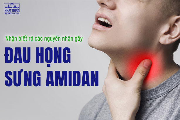 Nhận biết rõ các nguyên nhân gây đau họng sưng amidan