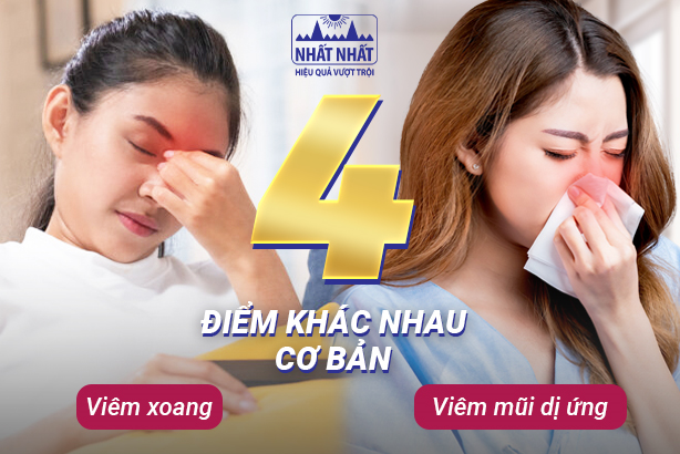 4 điểm khác nhau cơ bản giữa viêm xoang và viêm mũi dị ứng
