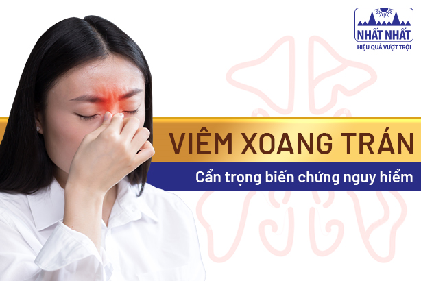 Viêm xoang trán: Cẩn trọng biến chứng nguy hiểm