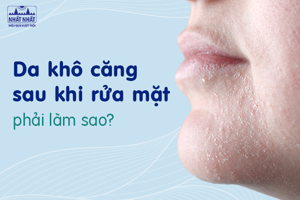 Da khô căng sau khi rửa mặt phải làm sao?