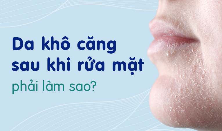 Da khô căng sau khi rửa mặt phải làm sao?