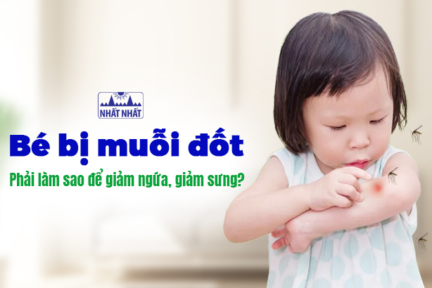 Bé bị muỗi đốt, phải làm sao để giảm ngứa, giảm sưng cho bé?