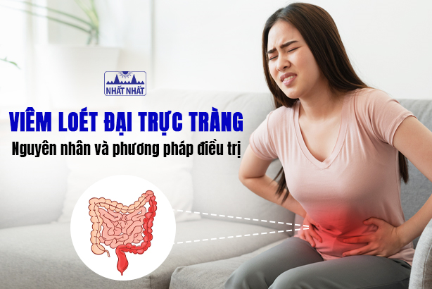 Viêm loét đại trực tràng: Nguyên nhân và phương pháp điều trị