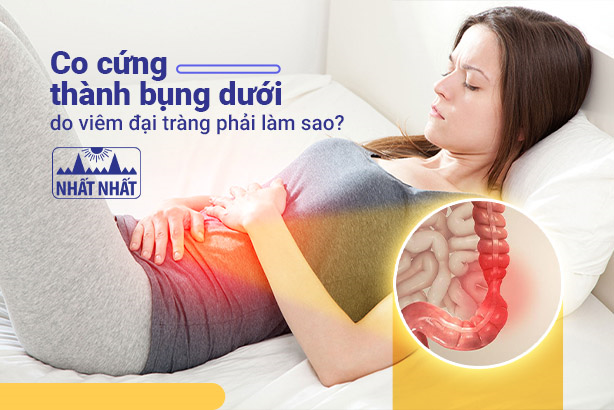 Co cứng thành bụng dưới do viêm đại tràng phải làm sao?