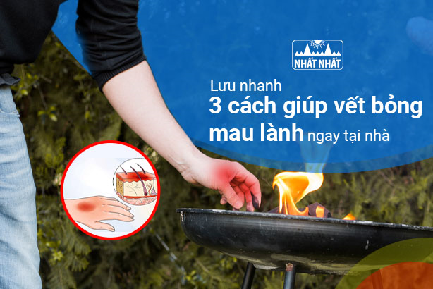Lưu nhanh 3 cách giúp vết bỏng mau lành ngay tại nhà