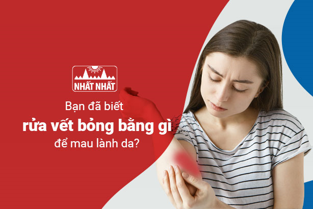 Bạn đã biết rửa vết bỏng bằng gì để mau lành da và không nhiễm trùng?
