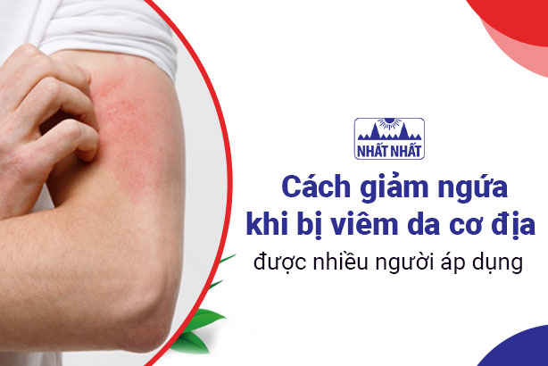 Cách giảm ngứa khi bị viêm da cơ địa được nhiều người áp dụng
