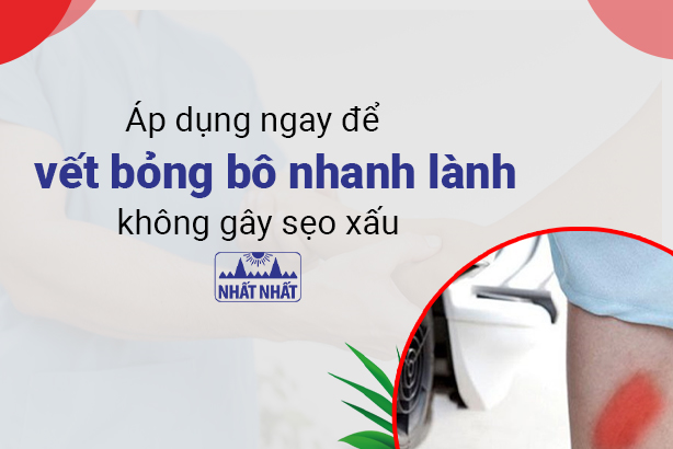 Áp dụng ngay để vết bỏng bô nhanh lành, không gây sẹo xấu