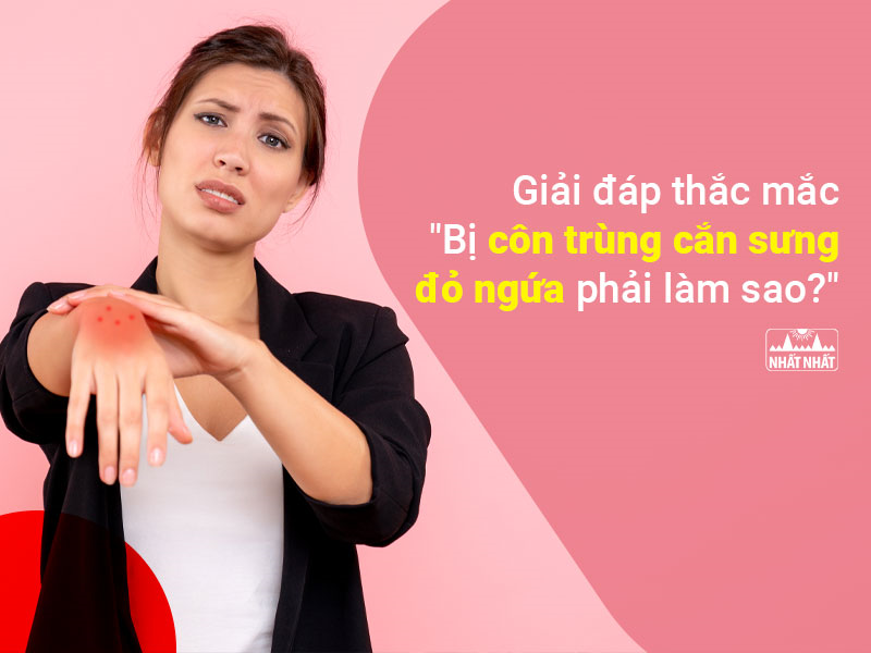 Giải đáp thắc mắc: “Bị côn trùng cắn sưng đỏ ngứa phải làm sao?”