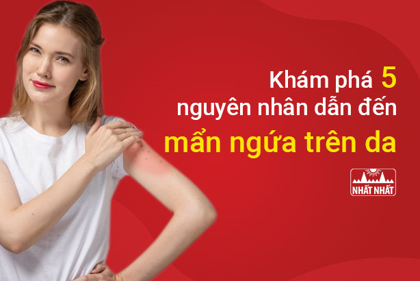 Khám phá 5 nguyên nhân dẫn đến mẩn ngứa trên da