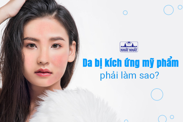Bạn có biết: Da bị kích ứng mỹ phẩm, phải làm sao?