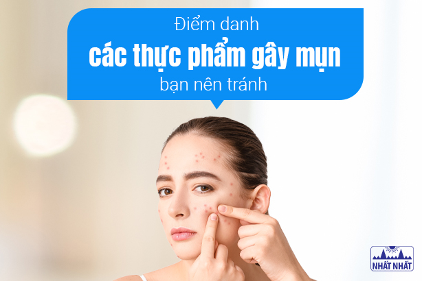 Điểm danh các thực phẩm gây mụn bạn nên tránh