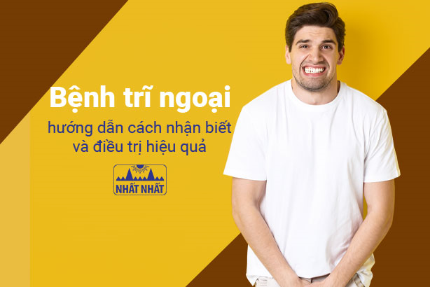 Bệnh trĩ ngoại: hướng dẫn cách nhận biết và điều trị hiệu quả