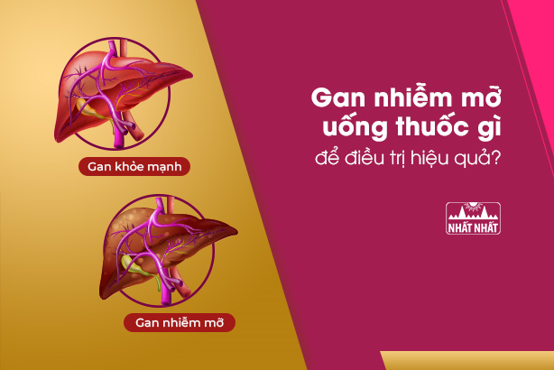 Gan nhiễm mỡ uống thuốc gì để điều trị hiệu quả?