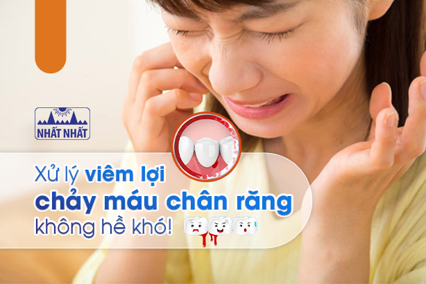 Xử lý viêm lợi chảy máu chân răng không hề khó!