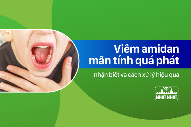 Nhận biết viêm amidan mãn tính quá phát và cách xử lý hiệu quả