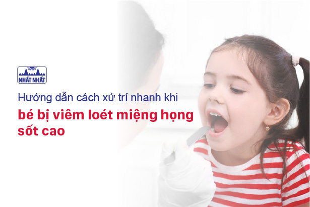 Hướng dẫn cách xử trí nhanh khi bé bị viêm loét miệng họng sốt cao