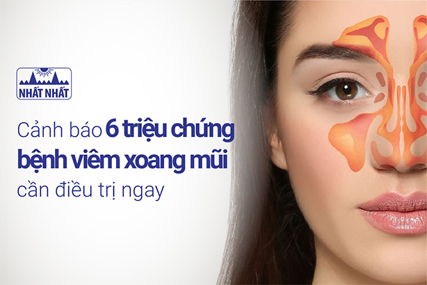 Cảnh báo 6 triệu chứng bệnh viêm xoang mũi cần điều trị ngay