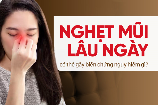 Nghẹt mũi lâu ngày có thể gây biến chứng nguy hiểm gì?