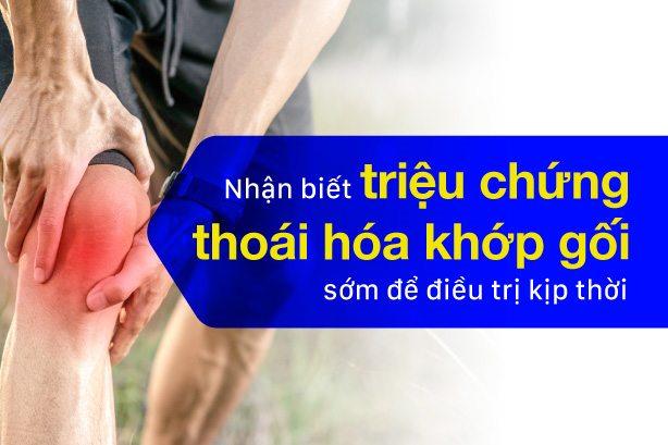 Nhận biết triệu chứng thoái hóa khớp gối sớm để điều trị kịp thời