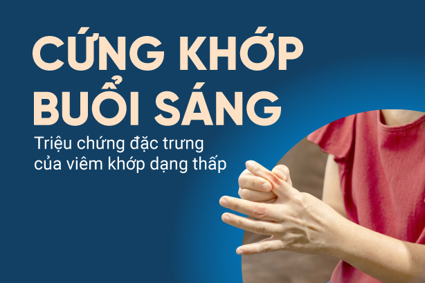 Cứng khớp buổi sáng – Triệu chứng đặc trưng của viêm khớp dạng thấp