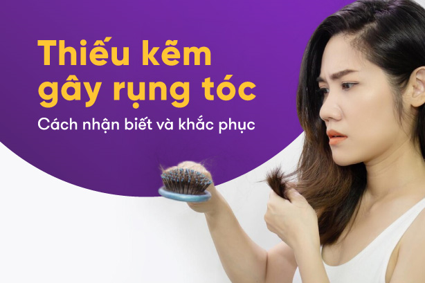 Thiếu kẽm gây rụng tóc – Cách nhận biết và khắc phục