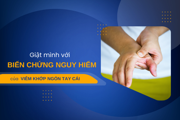 Giật mình với biến chứng nguy hiểm của viêm khớp ngón tay cái