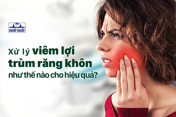 Xử lý khi bị viêm lợi trùm như thế nào cho hiệu quả?