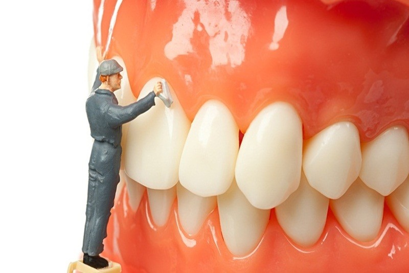 Phòng ngừa cao răng đơn giản hơn bạn nghĩ!
