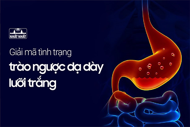 Cách phòng ngừa trào ngược dạ dày lưỡi trắng là gì?
