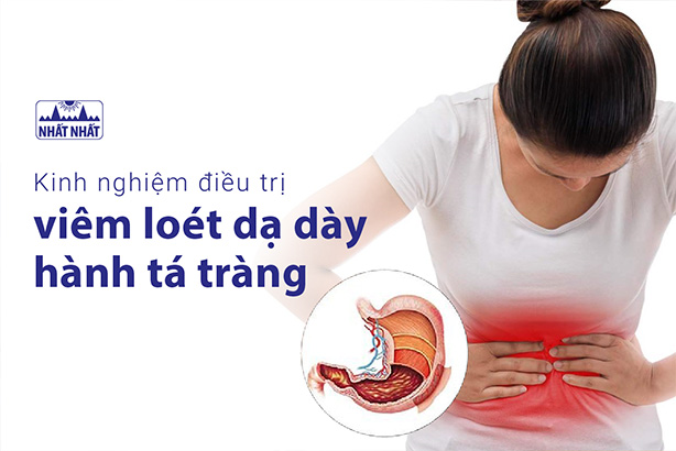 Kinh nghiệm điều trị viêm loét dạ dày hành tá tràng