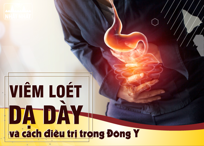 Viêm loét dạ dày và cách điều trị trong Đông Y