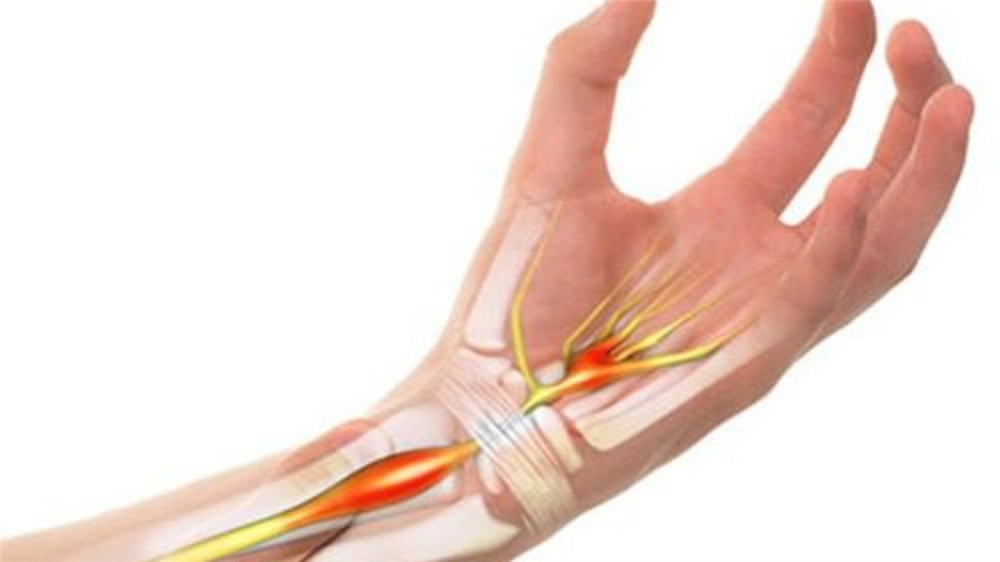 Tổng hợp các nguyên nhân thường gặp khiến bạn bị đau khớp cổ tay 