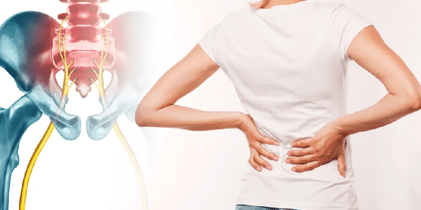 Nhận biết cơn đau thần kinh tọa và hình ảnh chẩn đoán rõ nhất