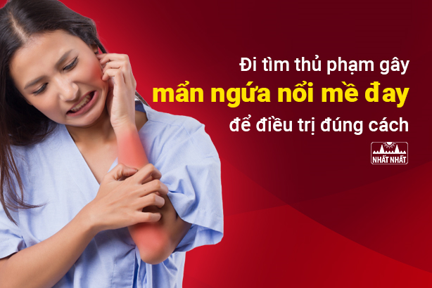 Đi tìm thủ phạm gây mẩn ngứa nổi mề đay để điều trị đúng cách