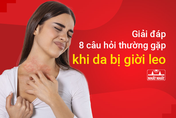 Giải đáp 8 câu hỏi thường gặp khi da bị giời leo