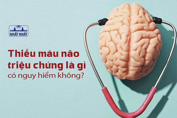 Thiếu máu não triệu chứng là gì? Khi nào nguy hiểm?