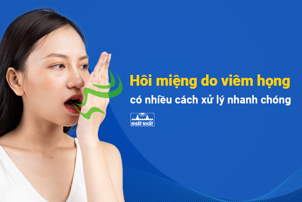 Hôi miệng do viêm họng: có nhiều cách xử lý nhanh chóng !