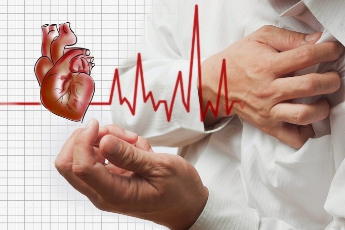 Đau thắt ngực là triệu chứng điển hình của bệnh mạch vành tim